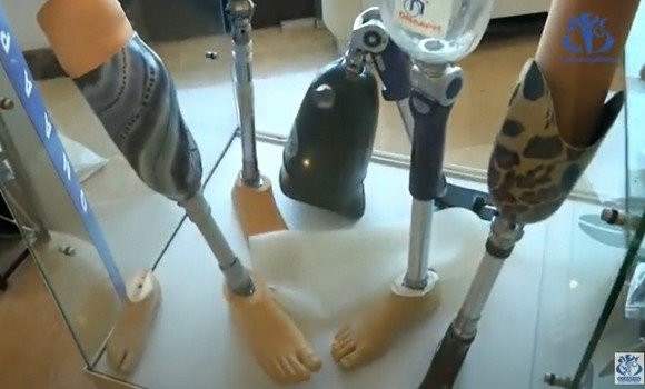 Plus de 127.000 personnes ayant des besoins spéciaux bénéficient de prothèses - Algérie